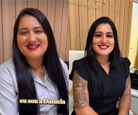 Resultado de transformação estética